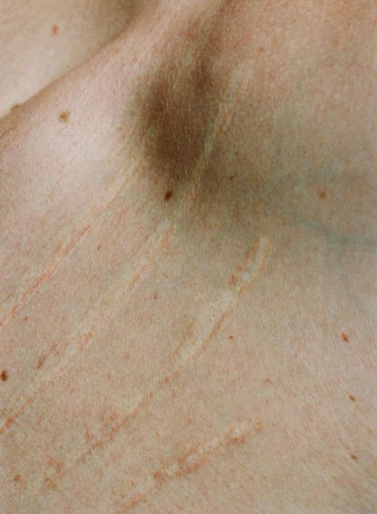 Sexothérapeute et thérapeute de couple